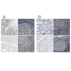 Immunohistochemical staining of human gastrointestinal, lymph node, skeletal muscle and tonsil using Anti-ITGB2 antibody HPA008877 (A) shows similar protein distribution across tissues to independent antibody HPA016894 (B).