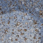 Immunohistochemical staining of human lymph node shows strong membranous positivity in germinal center cells.