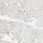 Immunohistochemical staining of human skeletal muscle shows no positivity in myocytes as expected.