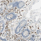 Immunohistochemical staining of human colon shows strong membranous positivity in lymphoid cells.
