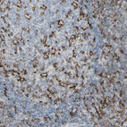 Immunohistochemical staining of human tonsil shows strong membranous positivity in germinal center cells.