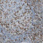 Immunohistochemical staining of human tonsil shows strong membranous positivity in germinal center cells.
