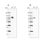 Western blot analysis using Anti-ITGB2 antibody HPA008877 (A) shows similar pattern to independent antibody HPA016894 (B).