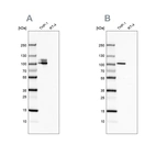 Western blot analysis using Anti-ITGB2 antibody HPA008877 (A) shows similar pattern to independent antibody HPA016894 (B).