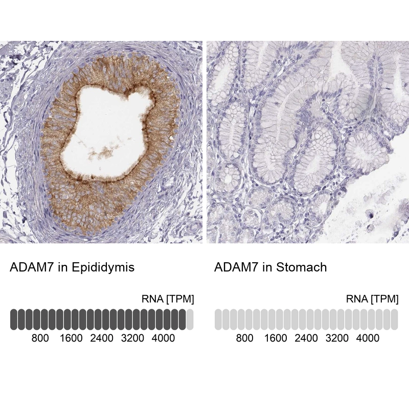 Rabbit Polyclonal Anti-ADAM7 Antibody - Buy for research - Highly ...