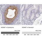 Anti-ADAM7 Antibody