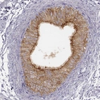Immunohistochemical staining of human epididymis shows high expression.