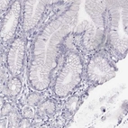 Immunohistochemical staining of human stomach shows low expression as expected.
