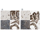 Immunohistochemical staining of human cerebral cortex, colon, lymph node and testis using Anti-ME2 antibody HPA008880 (A) shows similar protein distribution across tissues to independent antibody HPA008247 (B).