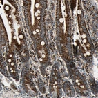 Immunohistochemical staining of human duodenum shows high expression.