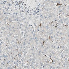 Immunohistochemical staining of human liver shows low expression as expected.