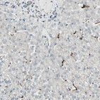 Immunohistochemical staining of human liver shows low expression as expected.