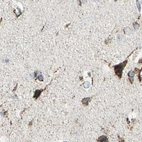 Immunohistochemical staining of human cerebral cortex using Anti-ME2 antibody HPA008880.