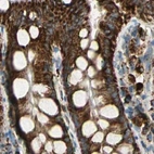 Immunohistochemical staining of human colon using Anti-ME2 antibody HPA008880.