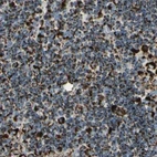 Immunohistochemical staining of human lymph node using Anti-ME2 antibody HPA008880.