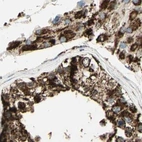 Immunohistochemical staining of human testis using Anti-ME2 antibody HPA008880.