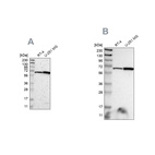 Anti-ME2 Antibody