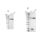 Western blot analysis using Anti-ME2 antibody HPA008880 (A) shows similar pattern to independent antibody HPA008247 (B).