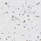 Immunohistochemical staining of human cerebral cortex shows strong nuclear positivity in glial cells.