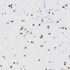 Immunohistochemical staining of human cerebral cortex shows strong nuclear positivity in glial cells.