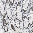 Immunohistochemical staining of human colon shows strong nuclear positivity in glandular cells.
