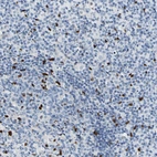 Immunohistochemical staining of human lymph node shows strong nuclear positivity in non-germinal center cells.