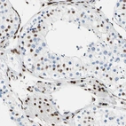 Immunohistochemical staining of human testis shows strong nuclear positivity in Leydig cells.