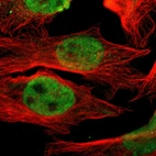 Immunofluorescent staining of human cell line U-2 OS shows localization to nucleoplasm & cytosol.