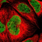 Immunofluorescent staining of human cell line A-431 shows localization to nucleoplasm.