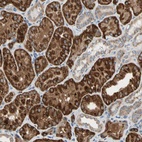 Anti-URB2 Antibody