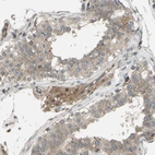 Immunohistochemical staining of human testis shows moderate cytoplasmic positivity in Leydig cells.