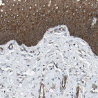 Immunohistochemical staining of human cervix, uterine shows strong cytoplasmic positivity in squamous epithelial cells.