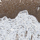 Immunohistochemical staining of human cervix, uterine shows strong cytoplasmic positivity in squamous epithelial cells.