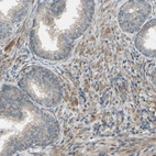 Immunohistochemical staining of human prostate shows moderate cytoplasmic positivity in smooth muscle cells.