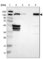 Lane 1: Marker [kDa] 230, 130, 95, 72, 56, 36, 28, 17, 11_br/_Lane 2: Human cell line RT-4_br/_Lane 3: Human cell line U-251MG sp_br/_Lane 4: Human plasma (IgG/HSA depleted)_br/_Lane 5: Human liver tissue