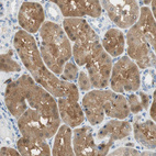Immunohistochemical staining of human Kidney shows moderate cytoplasmic positivity in cells in tubules.