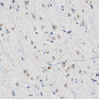 Immunohistochemical staining of human Cerebral cortex shows weak cytoplasmic positivity in neuronal cells.
