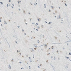 Immunohistochemical staining of human Cerebral cortex shows weak cytoplasmic positivity in neuronal cells.
