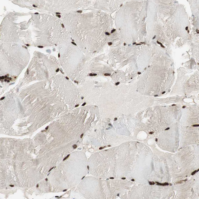 Anti-HEXIM1 Antibody