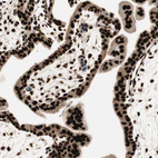 Immunohistochemical staining of human placenta shows strong nuclear positivity in trophoblastic cells.