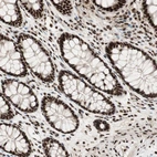 Immunohistochemical staining of human colon shows strong nuclear positivity in glandular cells.
