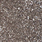 Immunohistochemical staining of human tonsil shows strong nuclear positivity in non-germinal center cells.