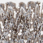 Immunohistochemical staining of human rectum shows strong granular cytoplasmic positivity in lymphoid cells.