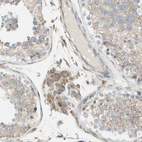 Anti-FNDC3A Antibody