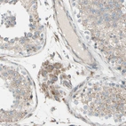 Immunohistochemical staining of human testis shows moderate granular cytoplasmic positivity in Leydig cells.