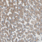 Anti-FNDC3A Antibody