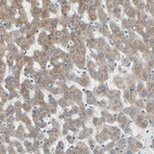 Immunohistochemical staining of human liver shows moderate granular cytoplasmic positivity in hepatocytes.