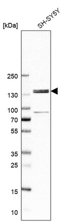 Anti-FNDC3A Antibody