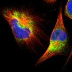 Immunofluorescent staining of human cell line U-251 MG shows localization to endoplasmic reticulum.
