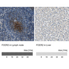 Anti-FCER2 Antibody